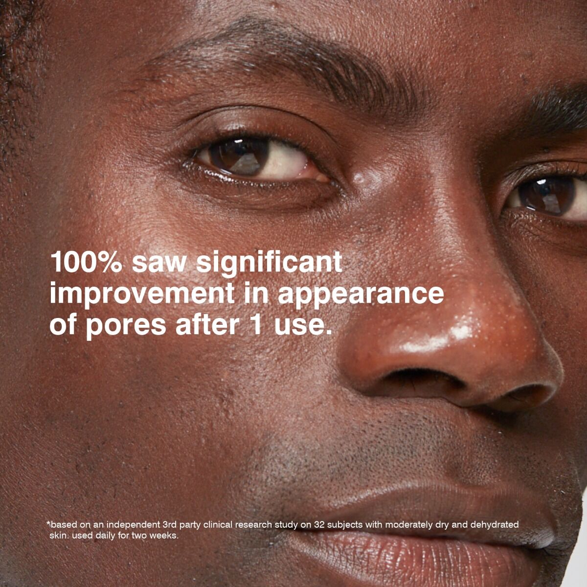 Close-up of a person's face with text about pore improvement after use of Malin+Goetz grapefruit face cleanser.